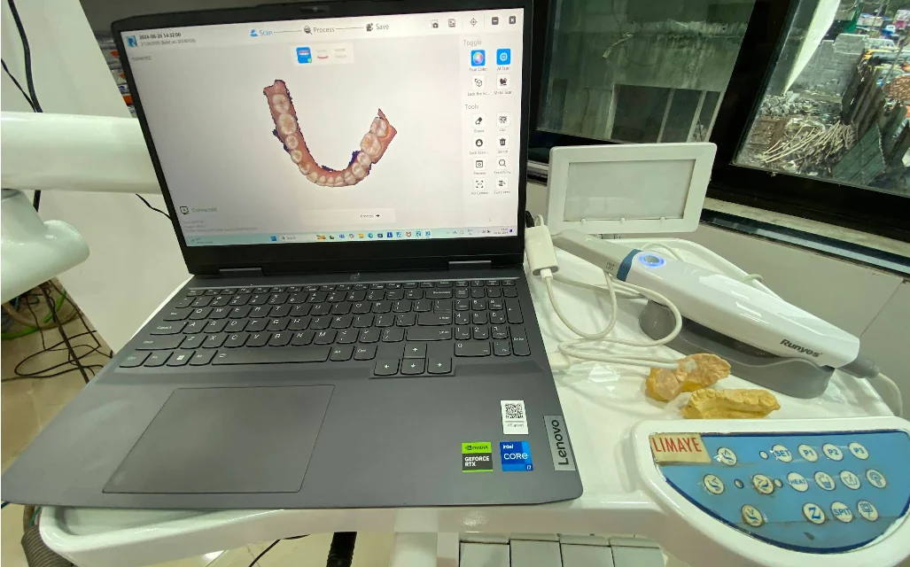 Digital dental scan displayed on a laptop